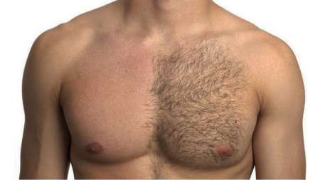 Épilation masculin